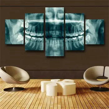 Стоматологический рентген зубов Стоматолог 5 шт. холст Настенная Художественная Картина Плакат Домашний Декор 5 Панелей HD Печать Фотографий Без Рамки 5 шт.
